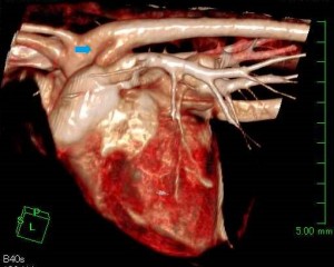 ‘torii purin pre op.jpg`